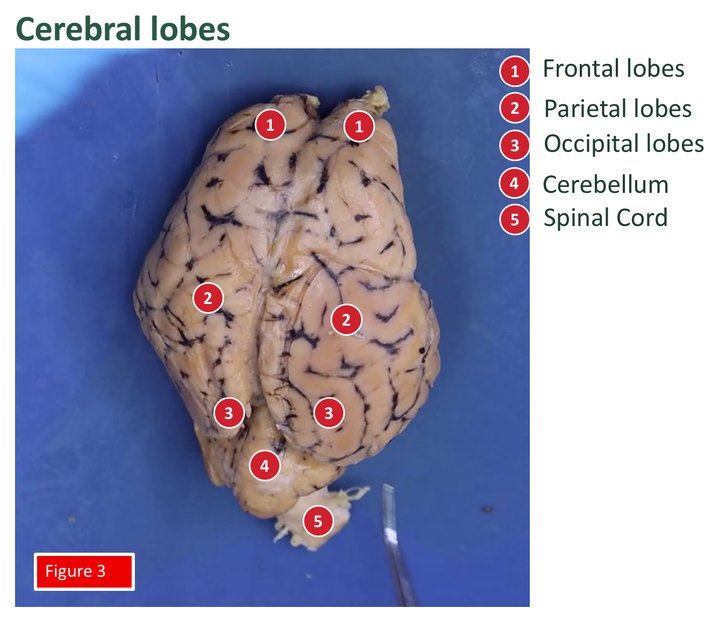 Labeled dorsal view of a sheep brain with a numbered key for the frontal, parietal, and occipital lobes, the cerebellum, and the spinal cord.