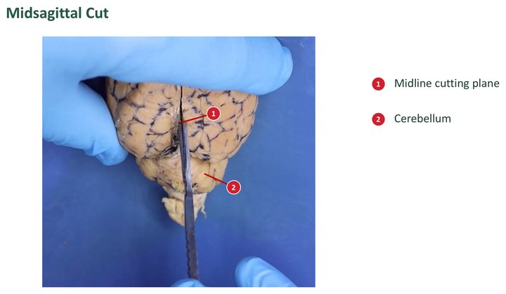 Labeled view of a sheep brain being cut along the midline, with a numbered key for the cutting plane and the cerebellum.