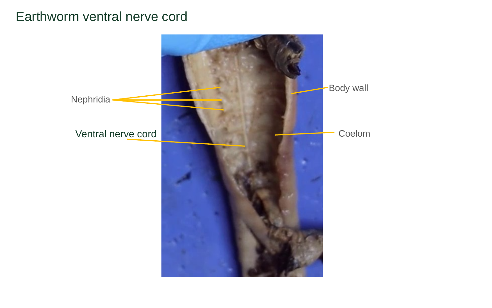Close-up with labels for the ventral nerve cord, body wall, coelom and general nephridia region.