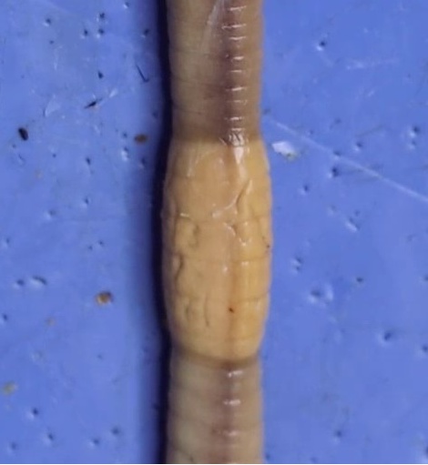 The clitellum and adjacent body segments.
