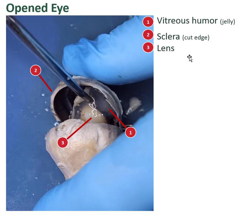 Labeled view of a sheep eye cut into two sections, with a numbered key for the vitreous humor, sclera, and lens.