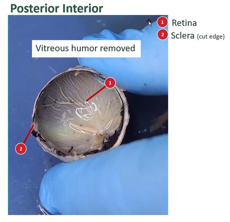 Labeled posterior half of a sheep eye after the vitreous humor was removed, with a numbered key for the retina and sclera.