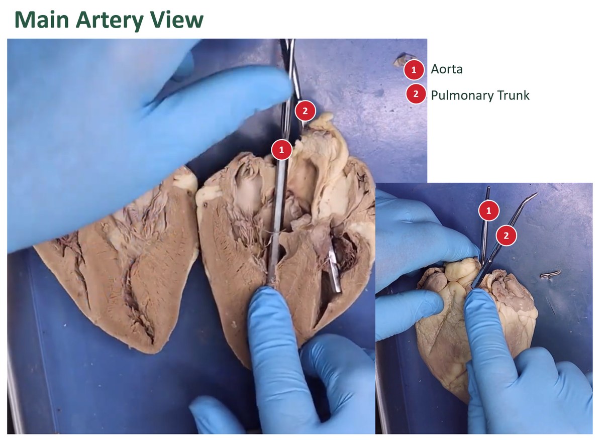 Labeled views of a dissected sheep heart with probes marking the aorta and the pulmonary trunk.