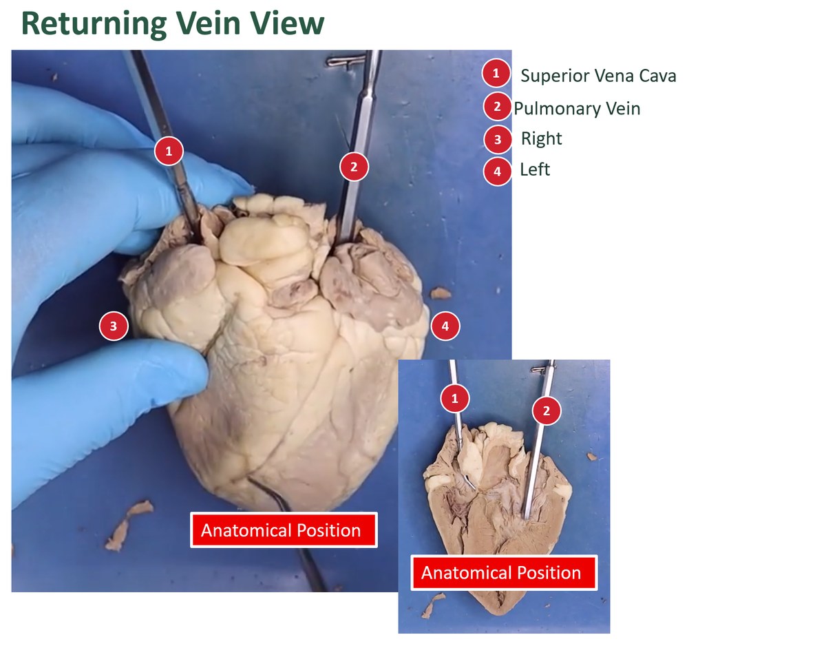Labeled external and opened views of a sheep heart with probes in the superior vena cava and a pulmonary vein.
