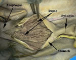 Rugae-Inside of Stomach